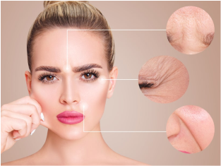 Anti-ageing