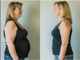 Weightloss